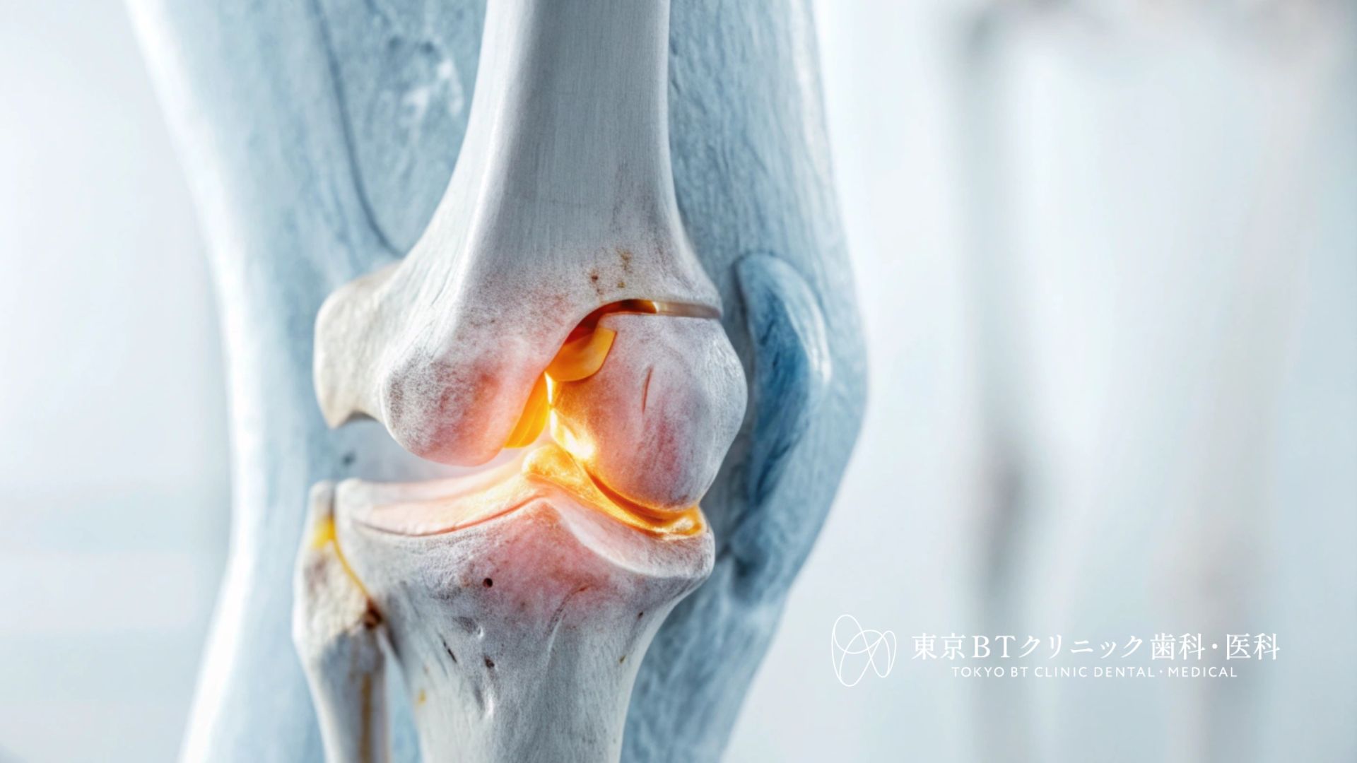 膝関節痛の再生医療～費用と効果を徹底解説します