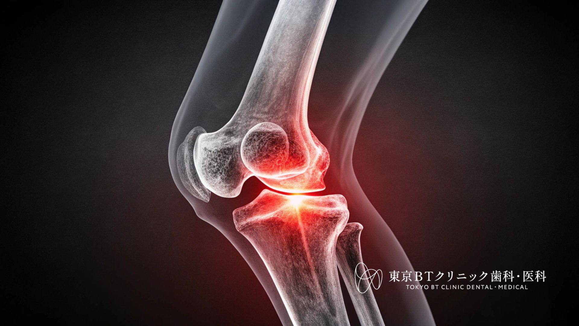 メスを使わない膝関節治療の最前線｜専門医が解説