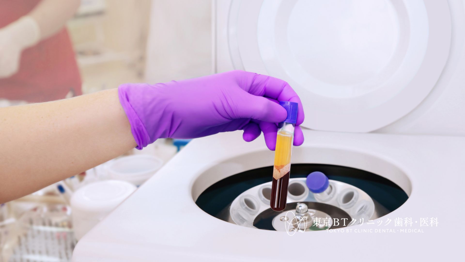 膝関節に治療に効果的なPRGF治療とは？効果・費用・従来療法との違いを専門医が解説