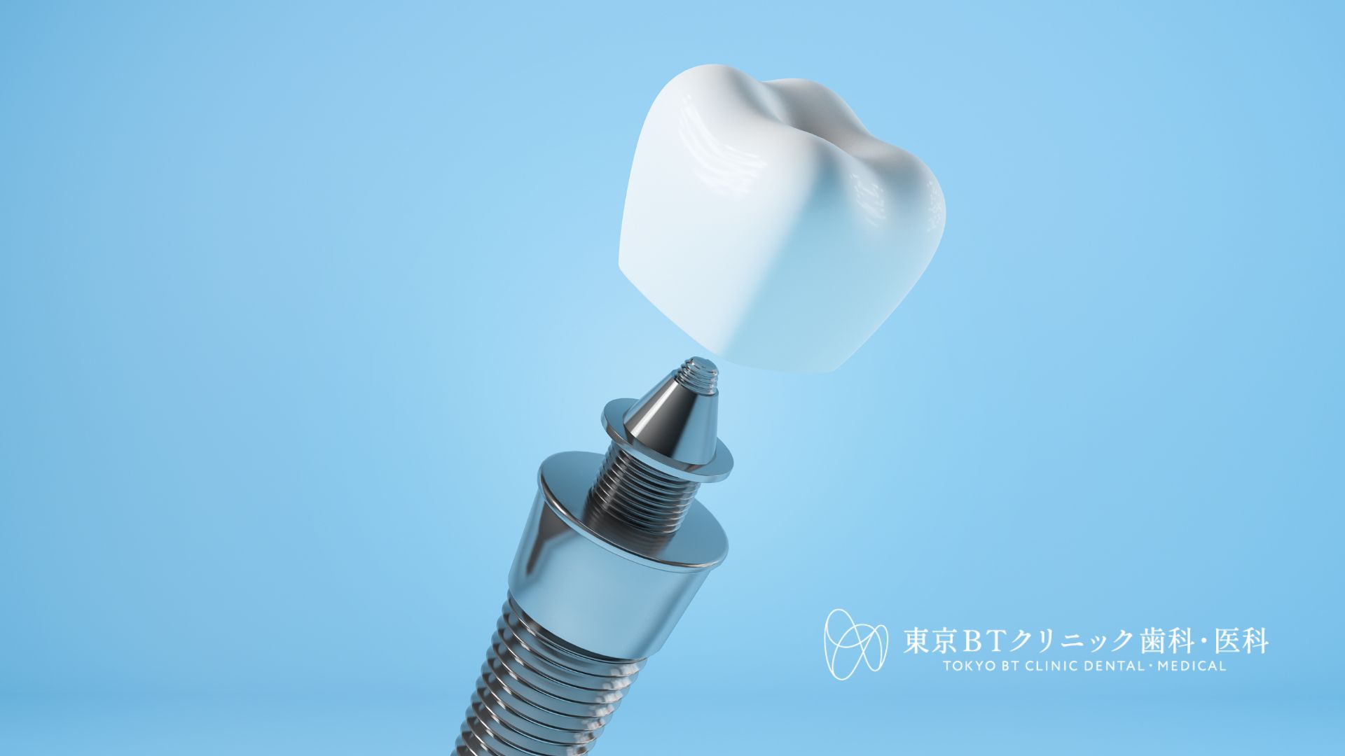 インプラント骨造成の痛みは?術後の経過とPRGF療法による軽減法